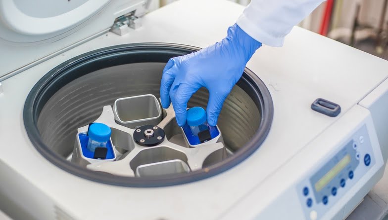 Extracting PRP from the blood in a centrifuge machine 