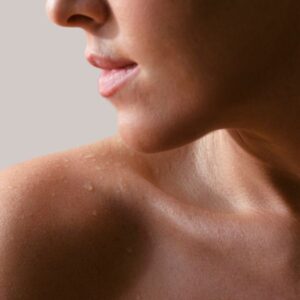 MyEllevate Neck Lift