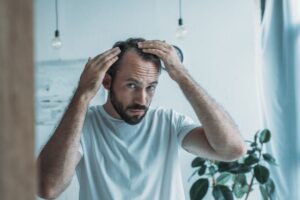 Top reasons for hair loss Philadelphia, PA