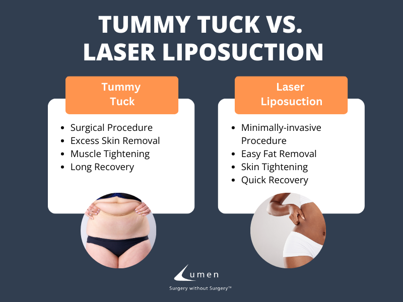 Tummy tuck vs. laser liposuction facts