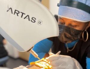 ARTAS