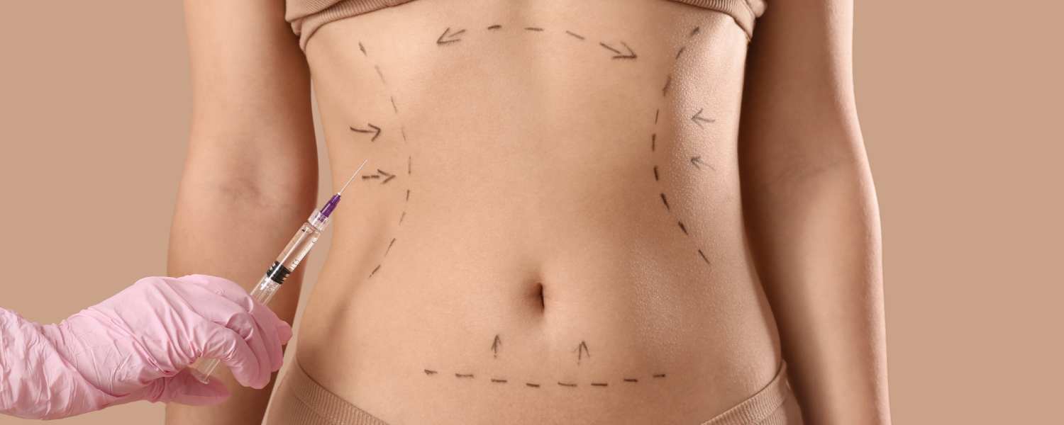 How Lipo 360 Works