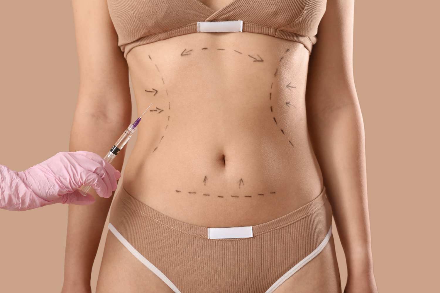 What is Lipo 360?