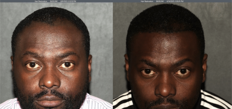 Lumen Website B&A (900 x 425 px) (1)