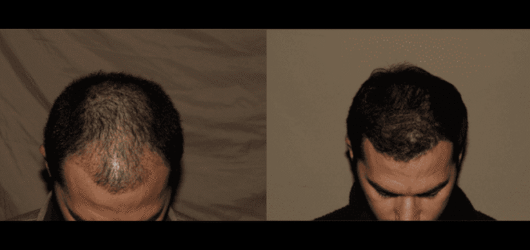 Lumen Website B&A (900 x 425 px) (10)