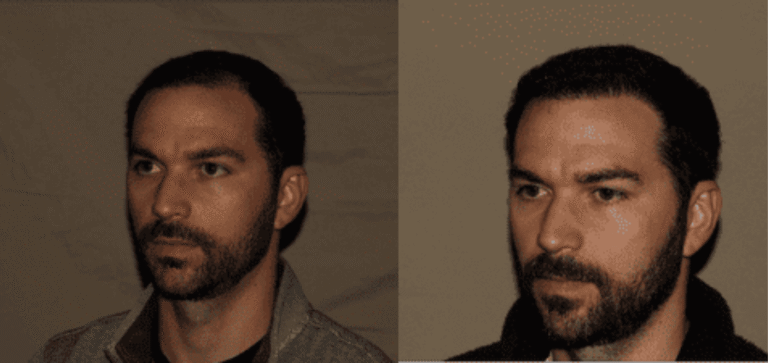 Lumen Website B&A (900 x 425 px) (2)