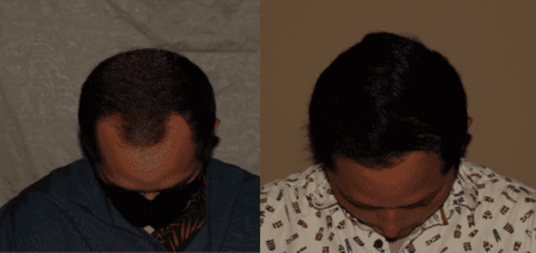 Lumen Website B&A (900 x 425 px) (3)