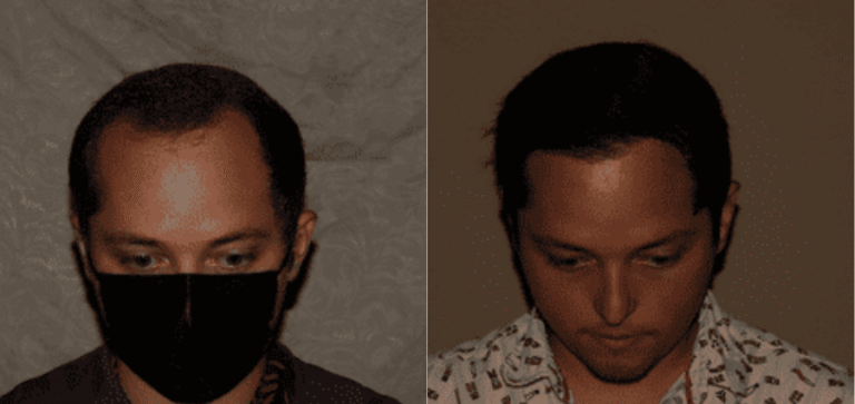 Lumen Website B&A (900 x 425 px) (4)