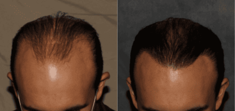 Lumen Website B&A (900 x 425 px) (5)