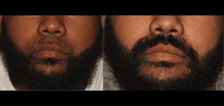 Lumen Website B&A (900 x 425 px) (6)