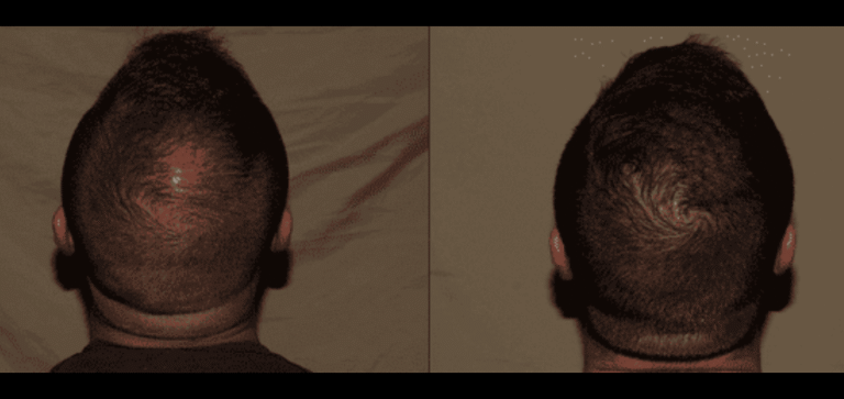Lumen Website B&A (900 x 425 px) (7)