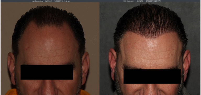 Lumen Website B&A (900 x 425 px)