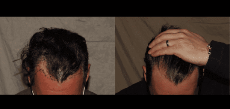 Lumen Website B&A (900 x 425 px) (8)