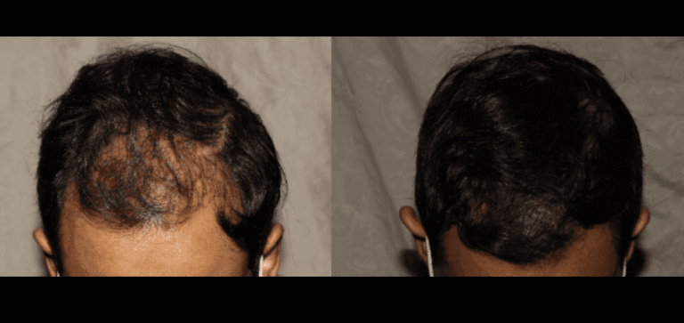 Lumen Website B&A (900 x 425 px) (9)