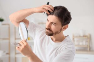 Hair Transplant Timeline