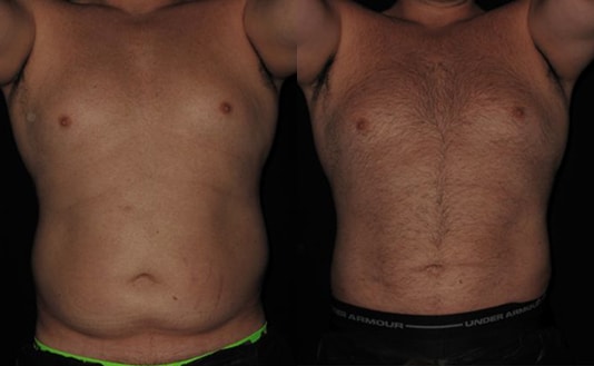 Lumen home BA 0101 3