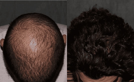 Lumen home BA 0202 1