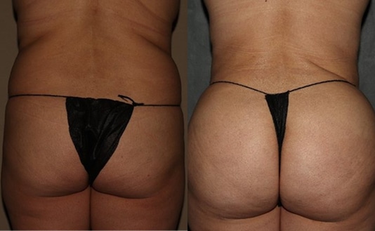 Lumen home BA 0303 2